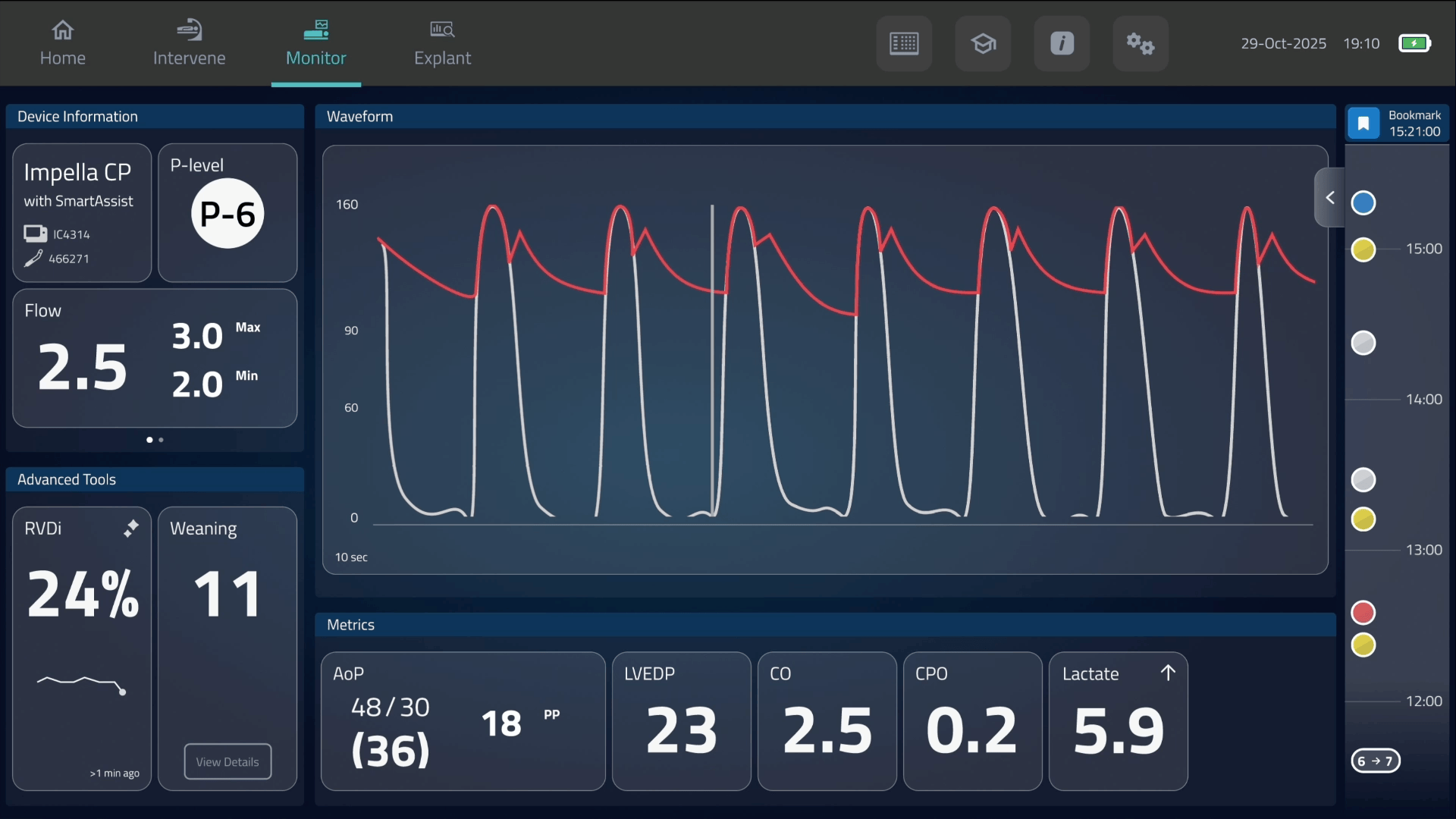 Modular Monitoring Layout