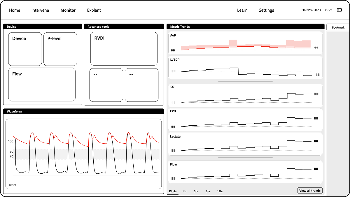 Wireframes - Trend Overview Layout